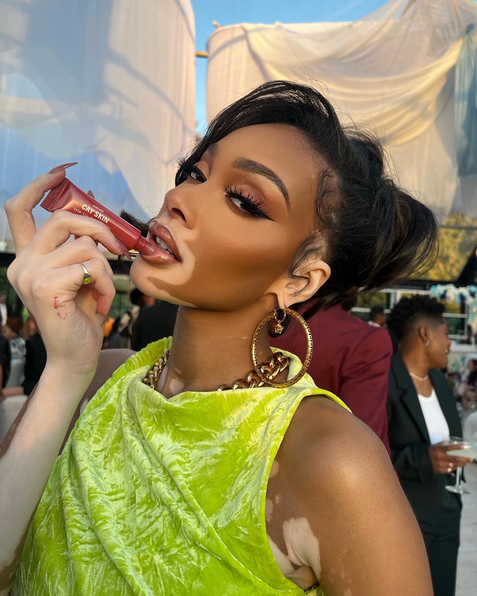 ♔Winnie Harlow♔ tweet media