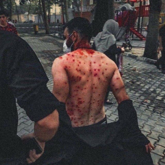 Hamidow10's tweet photo. آره داداش بدن انسان خیلی زیباست...!
#مهسا_امینی https://t.co/G4ouaM8bOF