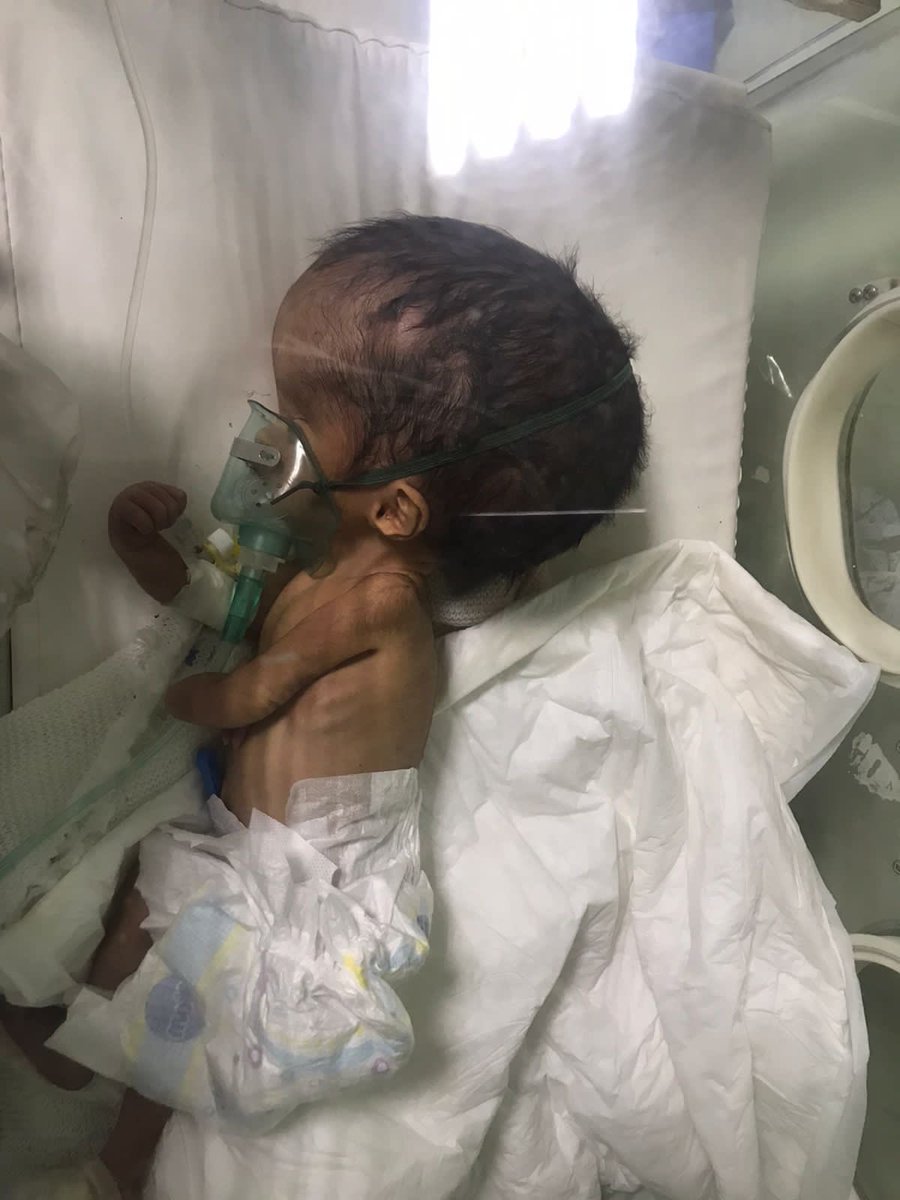 @CJohnsonYCCD Tell that to these kids born in the last few months. But I'm guessing you're so busy jerking off to an American flag, you don't even know where they were born or how you're responsible.