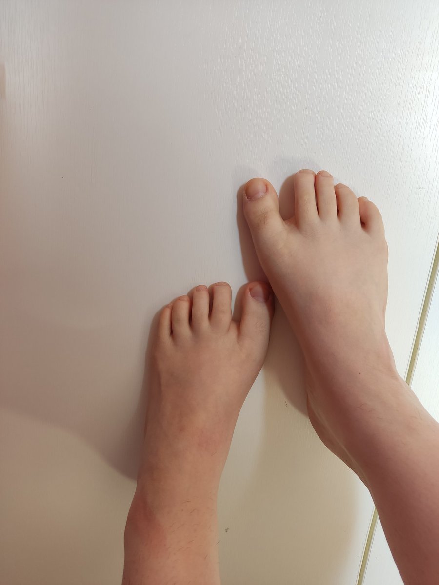 Feetvale_'s tweet photo. Hi! 🥰
See my content on:
https://t.co/T7Q07YPLWb

#feet #feetfethish #feetfinder #feetpicsforsales #feetpic #FeetPictures #soles #pinksoles #pies #Sellingcontents #SellingContent https://t.co/Z0KBQJt8b2