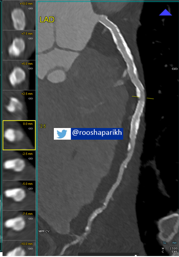 Roosha Parikh tweet media
