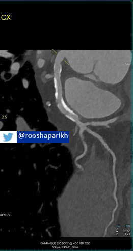 Roosha Parikh tweet media