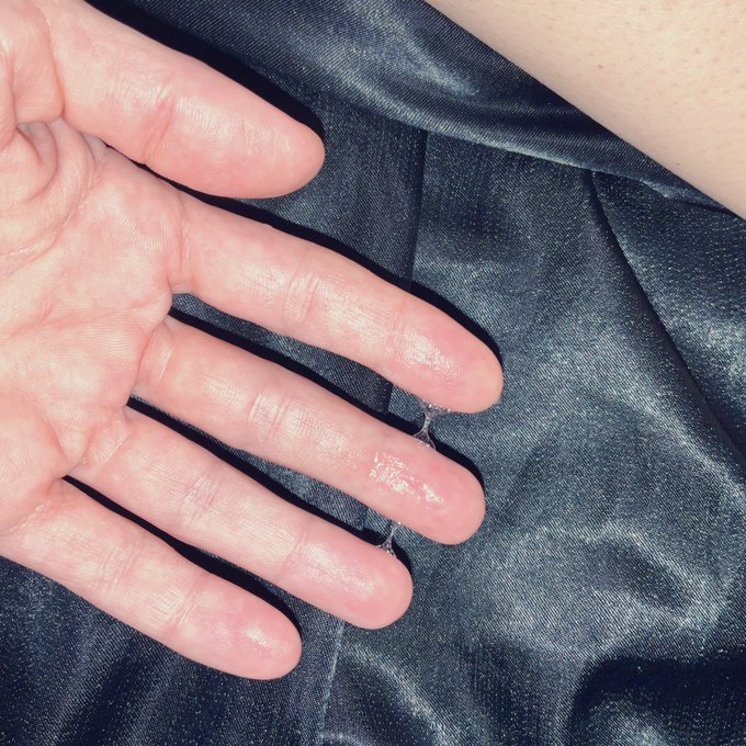 #Hypothermia #SelfLove #WYD #Wet #MILF X #Cannabis #YearoftheRabbit 😁 https://t.co/ckNXHbKwvx<a href="/tag/hypothermia"class="tags">#Hypothermia</a><a href="/tag/selflove"class="tags">#SelfLove</a><a href="/tag/wyd"class="tags">#WYD</a><a href="/tag/wet"class="tags">#Wet</a><a href="/tag/milf"class="tags">#MILF</a><a href="/tag/cannabis"class="tags">#Cannabis</a><a href="/tag/yearoftherabbit"class="tags"><span>#yearoftherabbit</span></a>