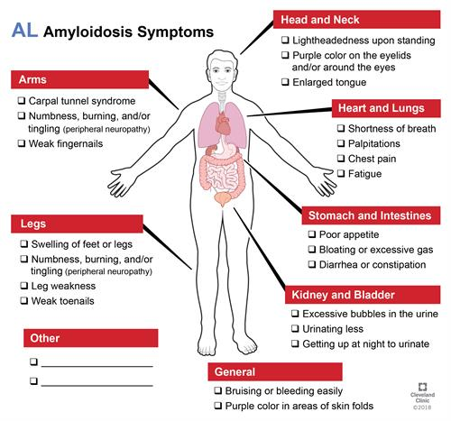 aVoice4ALS's tweet photo. 30 types of #amyloidosis
What type did #Musharraf have?
What organs affected?

AL amyloidosis is most common, but #ALECT2 is common among Latinos, Egyptians &amp; Punjabi communities.  Other common types = ATTR, AA.

Important opportunity to raise awareness.

https://t.co/xScEqxAmpO https://t.co/9LZU03jplH