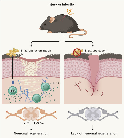 DrFAlzaid's tweet photo. Latest curated articles👇🏽
📰When IL-17 gets on your #nerves (📷)
📰Human #IRF1 governs macrophagic #IFN-γ #immunity to mycobacteria
💱The value of applied #science
🔗https://t.co/mwRxEpacu3
🙏🏽Thx @Bims_BiomedNews https://t.co/tDC8YhpGWz