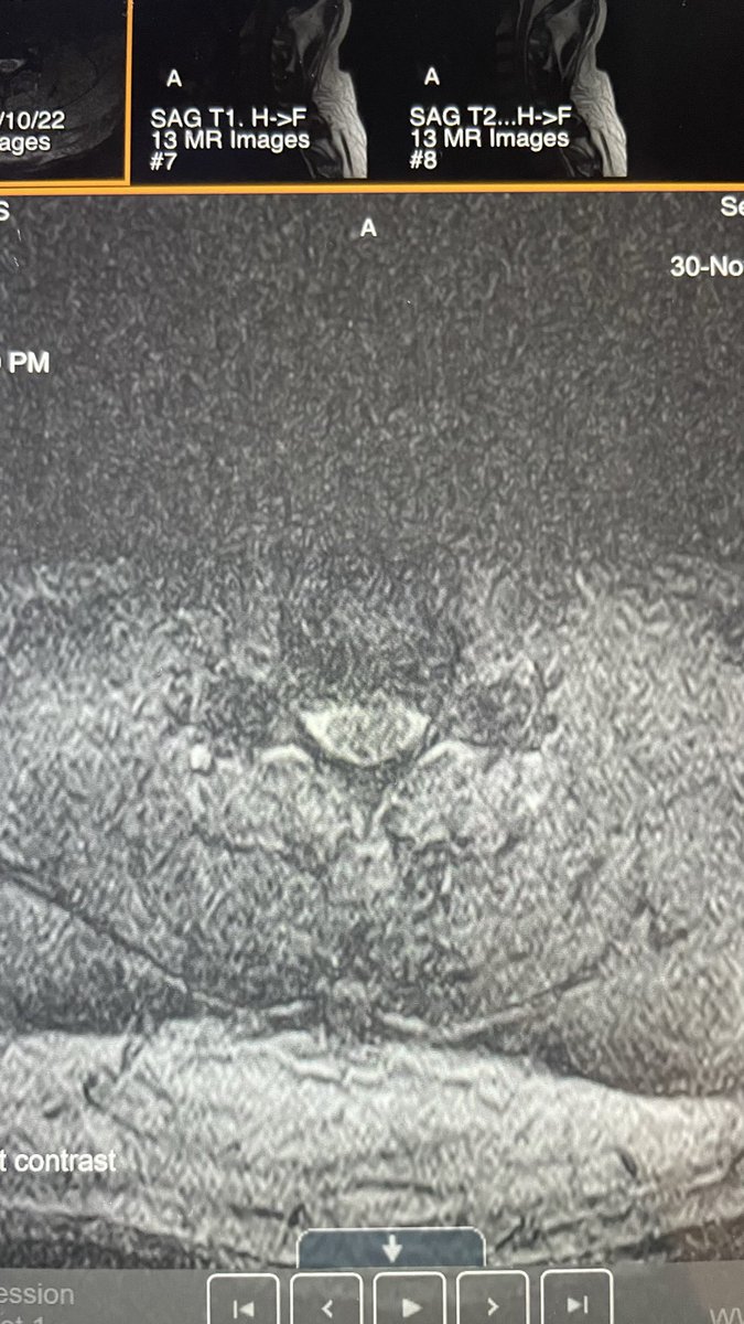 Thomas Scully MD tweet media