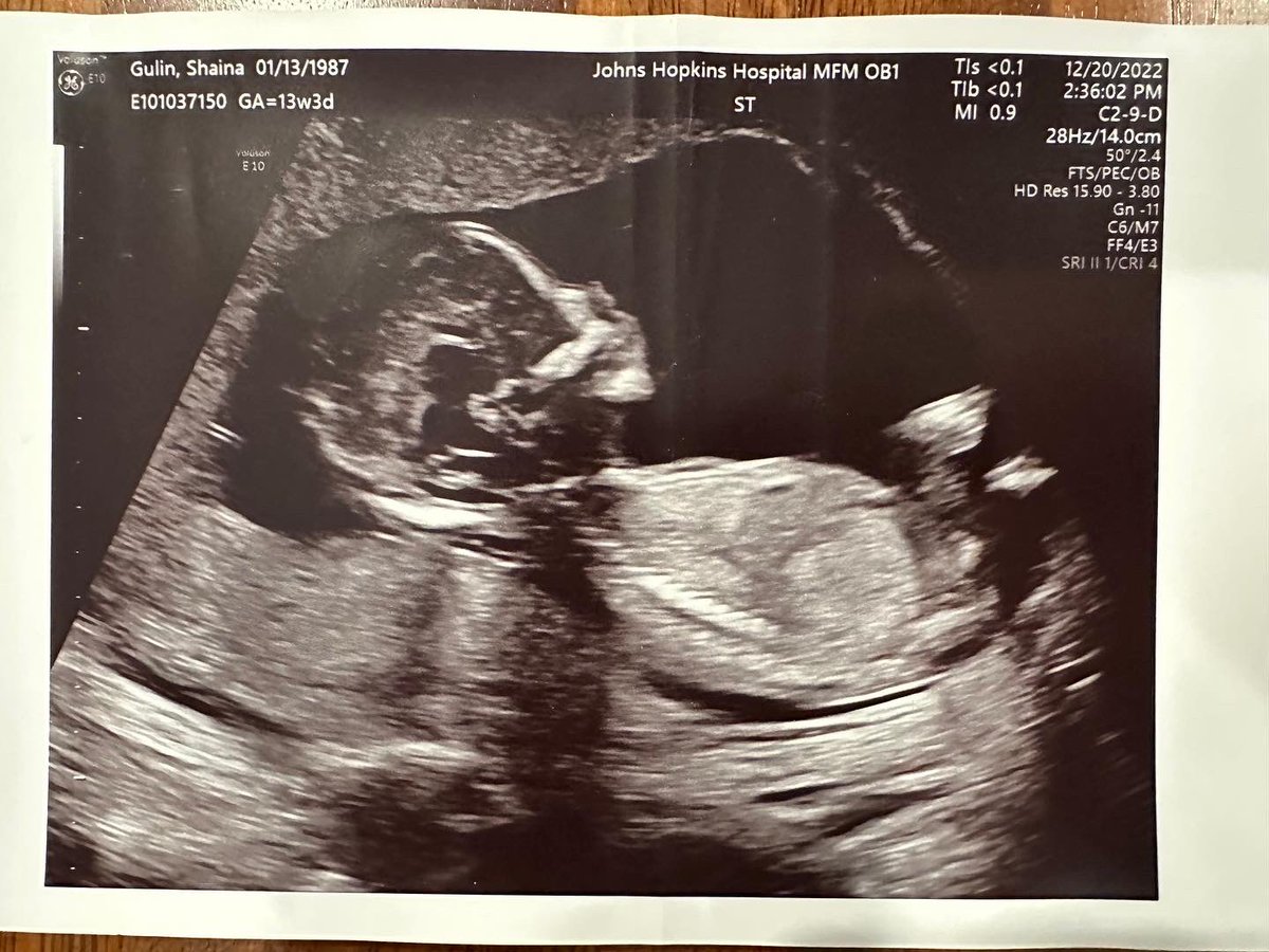 Mark Edelson tweet media