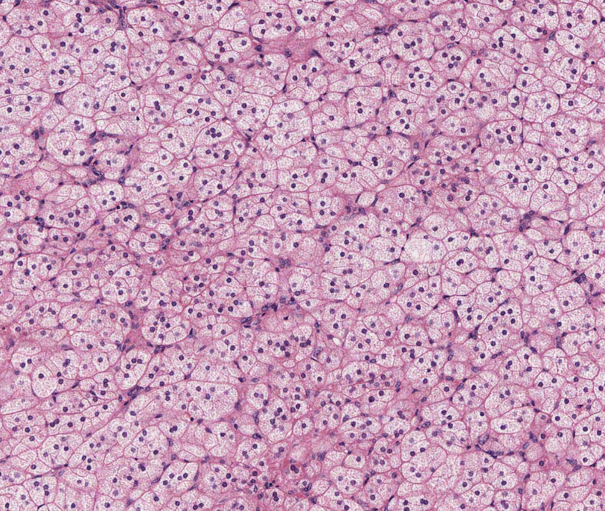 Akshay Agarwal, MD FrcPath tweet media