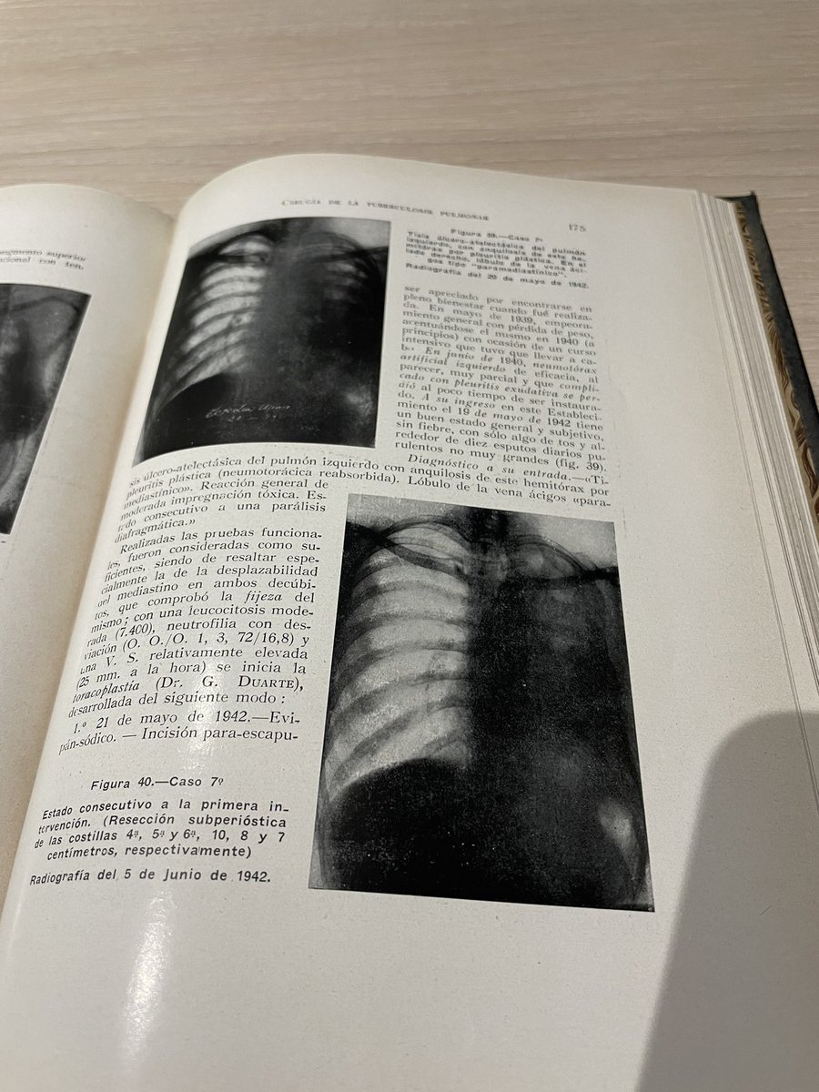 AngelCilleruelo's tweet photo. Hace unos días un anestesista de mi hospital me ha regalado esta joya de 1944.  

🦠🫁El origen de la cirugía torácica como especialidad está ligado con el tratamiento quirúrgico de las infecciones respiratorias, un tema prácticamente “olvidado” en nuestro día a día. https://t.co/CNQ9Zjoo8w