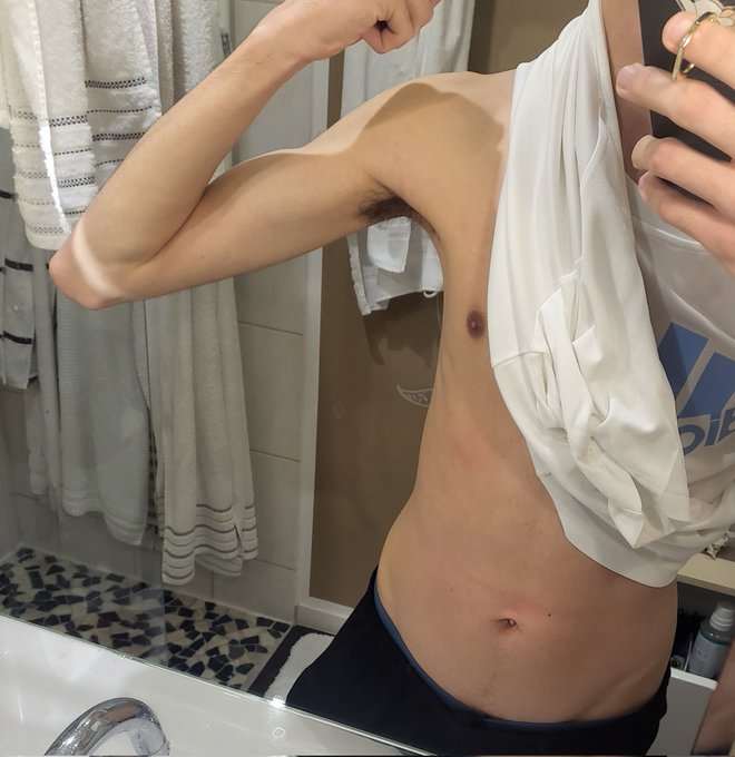 Bald 22! https://t.co/EM1ax2kQOc