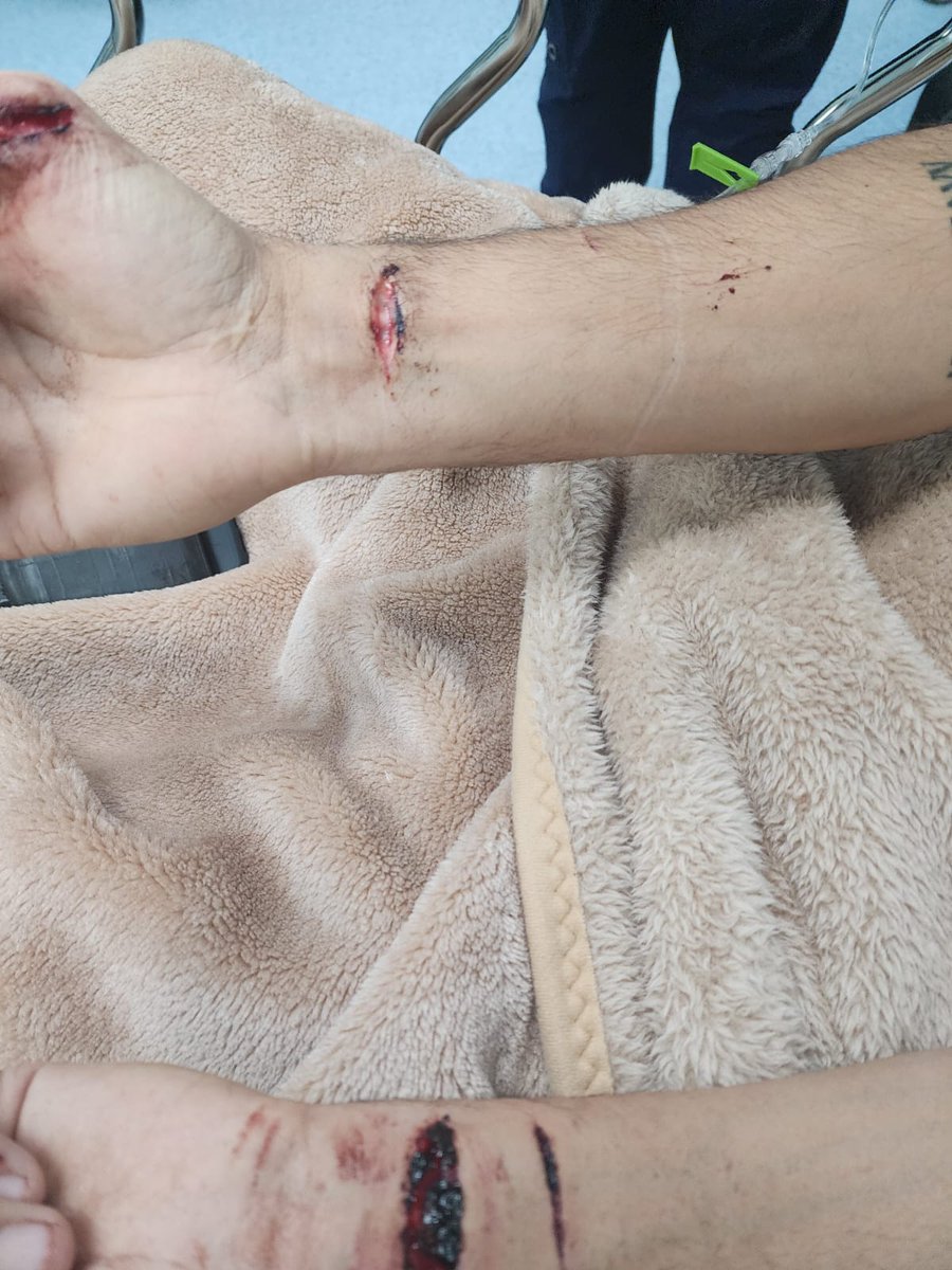 Ramiro_Escoto's tweet photo. #ImagenesFuertes el ahora detenido acusado de tentativa de Homicidio en agravio de su #ExEsposa Sandra Paola, Alejandro N ingresó a un hospital tras intentarse quitar la vida. Se recuperó la camioneta de Sandra en el estacionamiento del Hospital. (Fotos: @escamillajluis ) https://t.co/yDOZ63IldQ