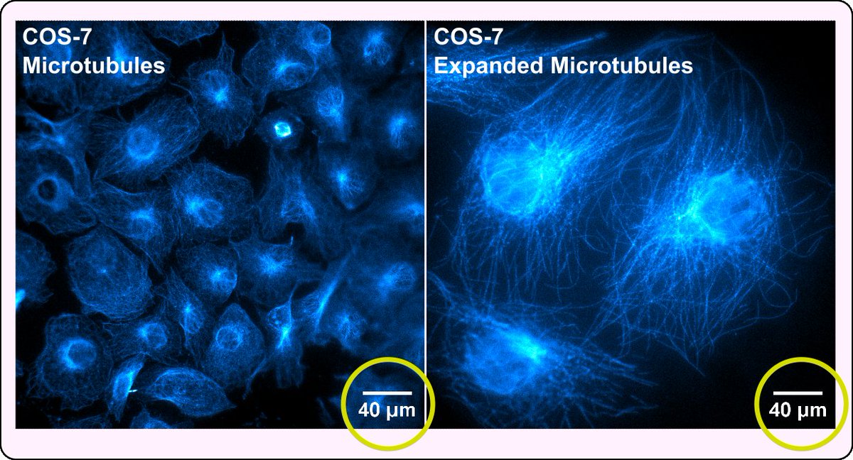 First time doing expansion microscopy at La Trobe Bendigo. Expanded microtubule architectures under the same FOV looking much larger and revealing more filament detail 😁 

#expansionmicroscopy #EverydayExpansion #fluorescence #microscopy #latrobeuni #LaTrobeRHS