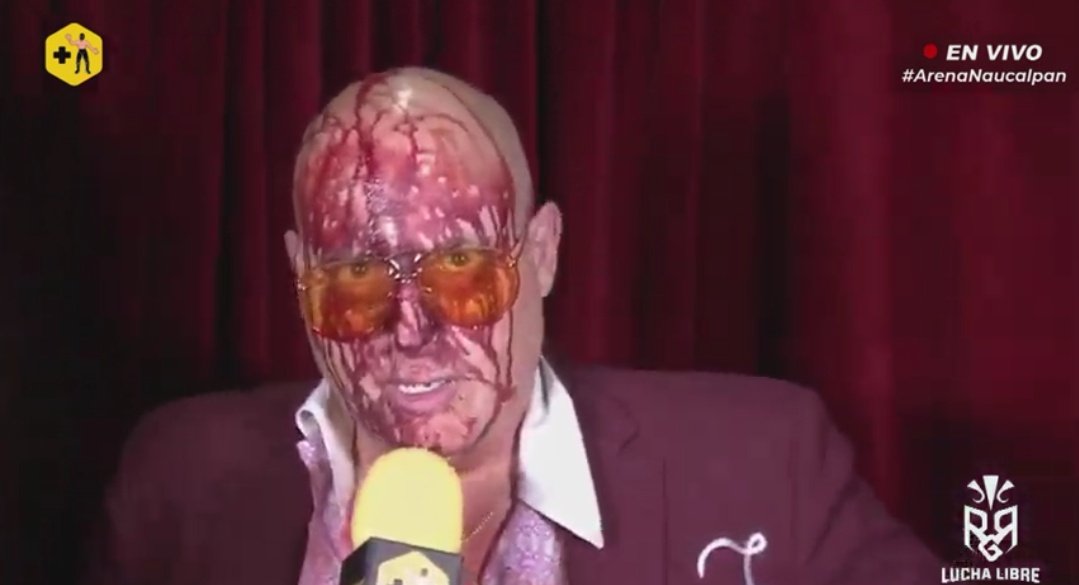 ChirpingBlueJay's tweet image. It was a crazy night for
#JackFancy in #MexicoCity.
 #ArenaNaucalpan #LAPARK @mas_lucha #Wrestling #WrestlingTwitter 
#LuchaLibre #WrestlingCommunity #prowrestling #LosParks @luchalibreonlin #RGRluchalibre @LUCHALIBREIWRG #WCW  #WrestlingTwitter @realJackFancy @laparktapia