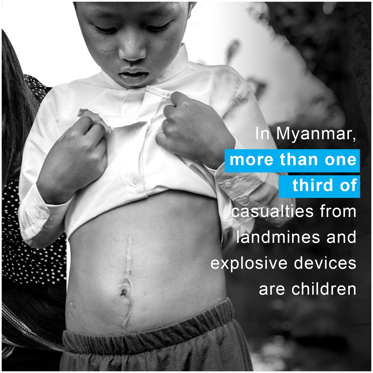 UNICEFMyanmar's tweet photo. Children should never be the victims of landmines and explosive devices – in #Myanmar or elsewhere. Stop the use of landmines now. 

#GenerationInPeril https://t.co/ApfShebiHS