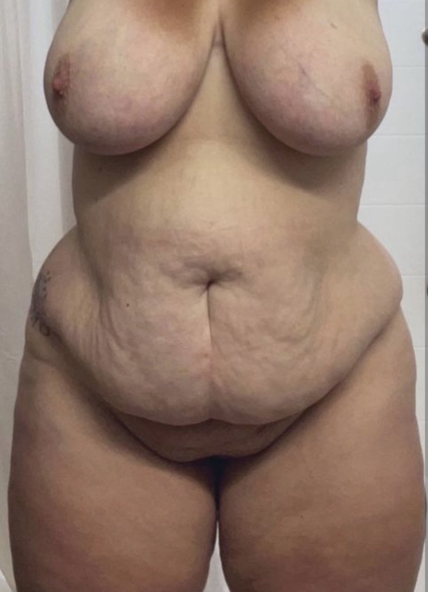 Зәр шығару өзегі бітеліп қалады