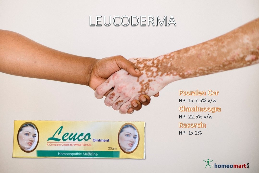 homeomart's tweet image. Psoralea Cory is best ancient remedy used for kusthroga and #Leucoderma with powerful action against the skin streptococci. Topically beneficial in the treatment of leucoderma. Arsenic Sulph Flav is another good remedy for loss of pigmentation in skin.  bit.ly/hmmrt_vitiligo