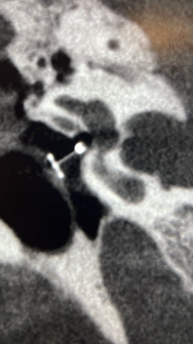 Interesting one. What is it and is it normally positioned?