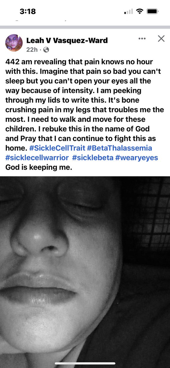 It’s 3:18 am and like my dear friend Leah a #SickleCellWarrior I too am dealing with my #sicklecell pain.