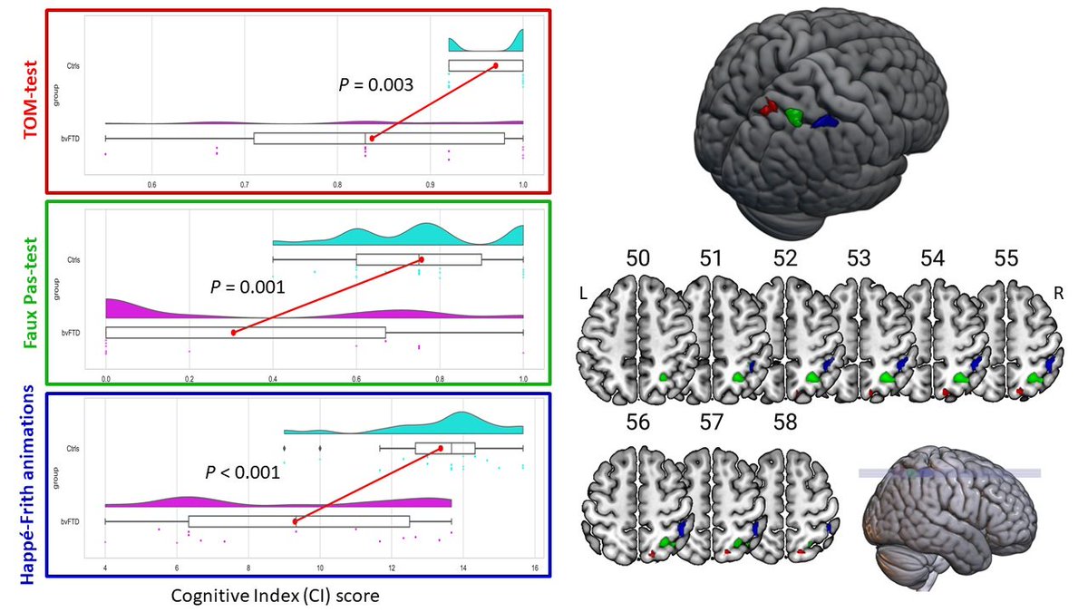 NeuropsyKUL's tweet photo. Check out our latest Letter to the Editor in @Brain1878 !

We replicated and validated the approach of Campanella et al. in 3 transdiagnostic studies; 
revealing Superior Parietal Lobe specificity in cognitive Theory of Mind

Great replication work!

https://t.co/cOLd8uXdl0 https://t.co/gfuabXWPaL