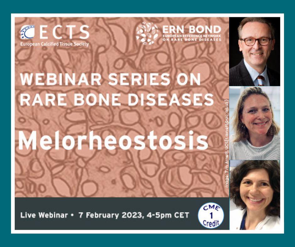 💻Melorheostosis – Webinar series in rare bone disease
🗓7th February 2023, from 16:00 to 17:00 (CET)
👥Hosts: Dr. Natasha Appelman-Dijkstre, Dr. <a href="/futurenat/">Natalie Butterfield</a> 
🗣Speaker: Dr. <a href="/GeertMortier2/">Geert Mortier</a> 
Jointly organized by <a href="/ern_bond/">European Reference Network on Rare Bone Diseases</a> and <a href="/ECTS_science/">ECTS_Science</a> <a href="/ECTS_soc/">ECTS</a> #ERNeu #ERNs #RareDisease