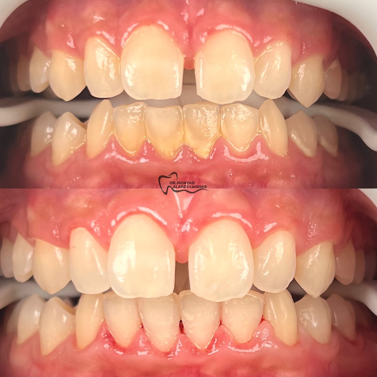 مؤيد tweet media