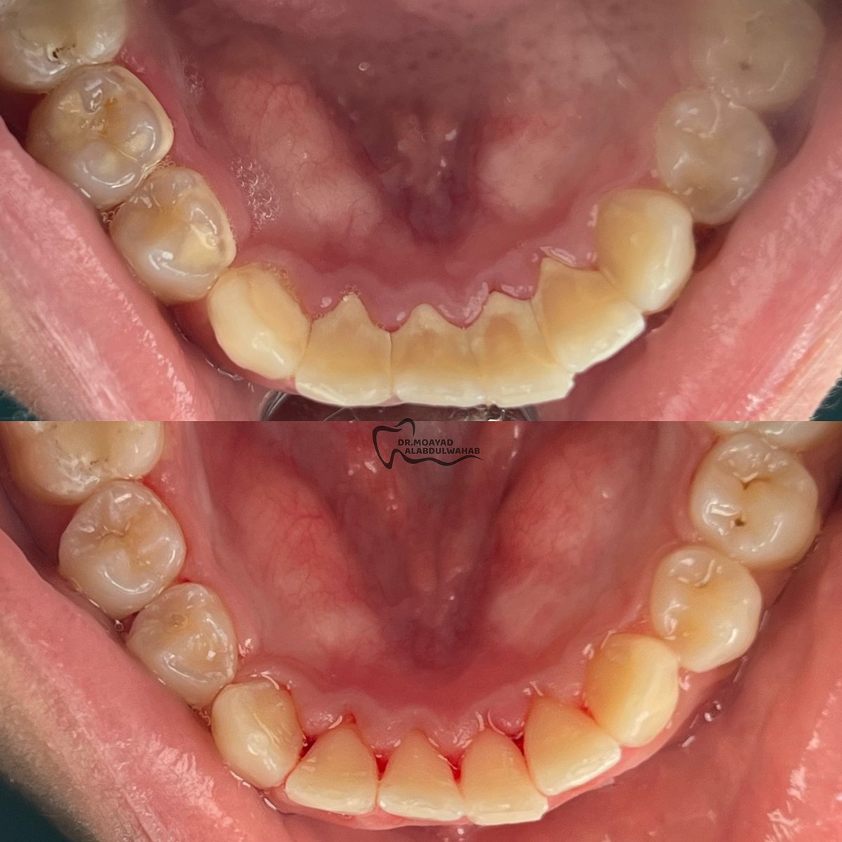 مؤيد tweet media