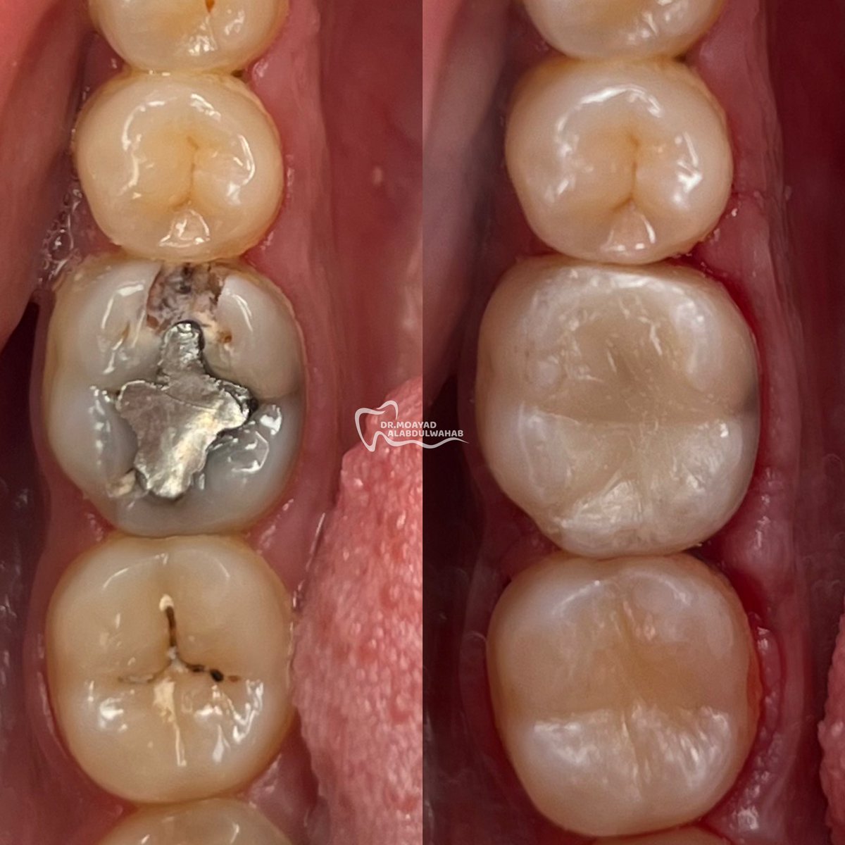 مؤيد tweet media