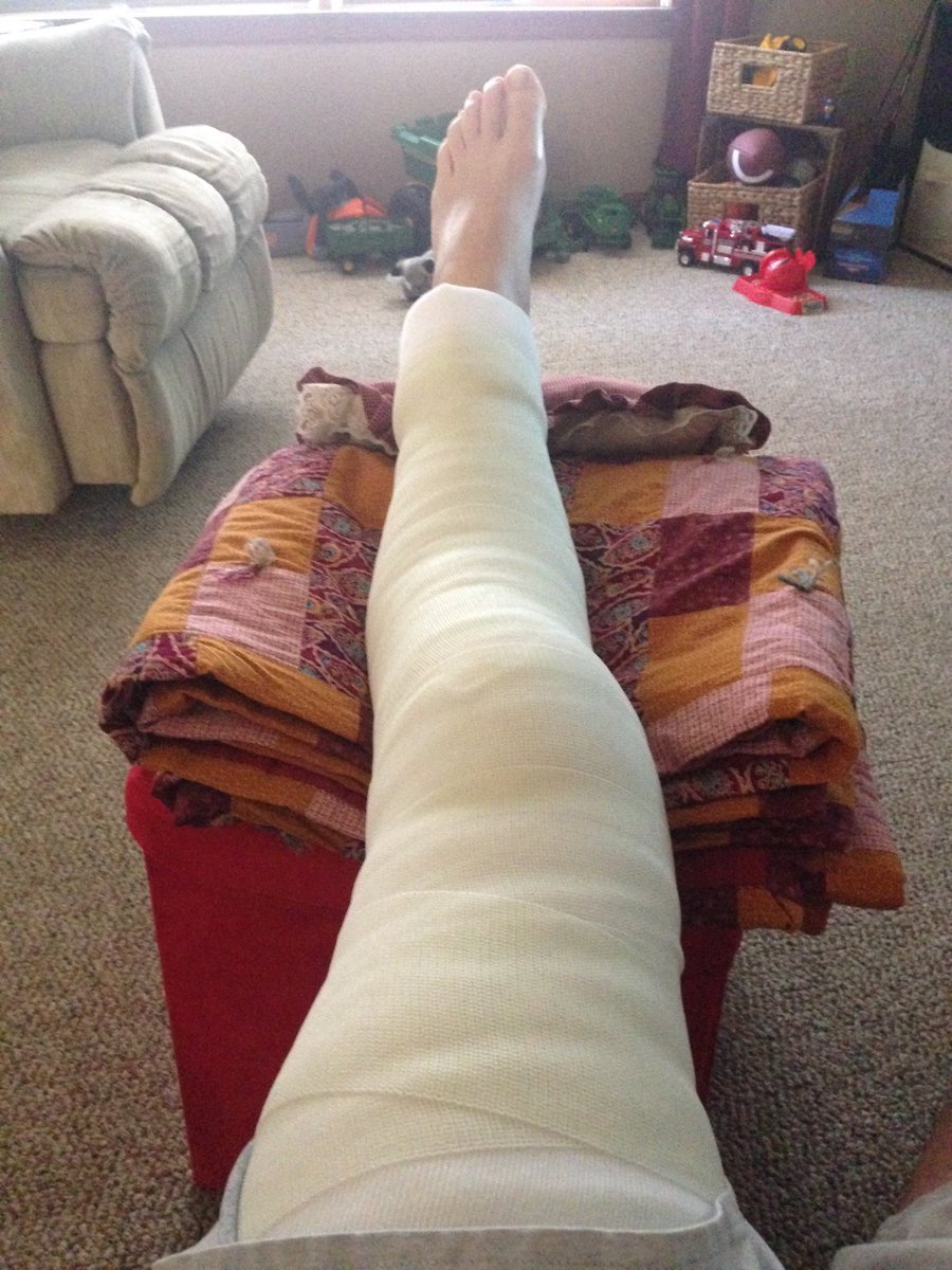 CoachNeumayer's tweet photo. @RB_Mrs It’s real…torn patella tendon as a 39 yr old dad tryin to dunk via trampoline @skyzone #worstpainever 😄 https://t.co/2ztlzSP6bY