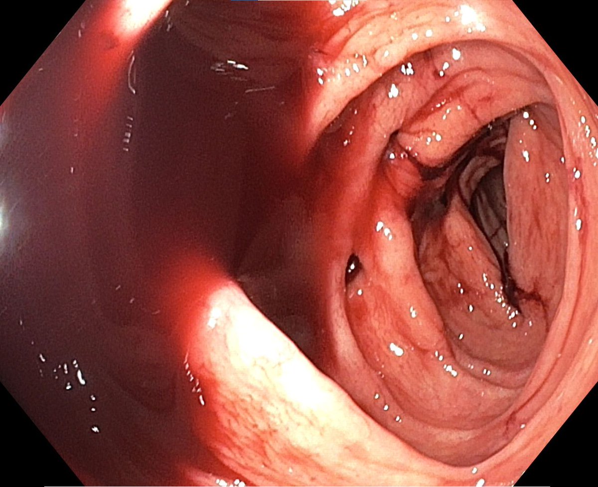Alexander Hann tweet media