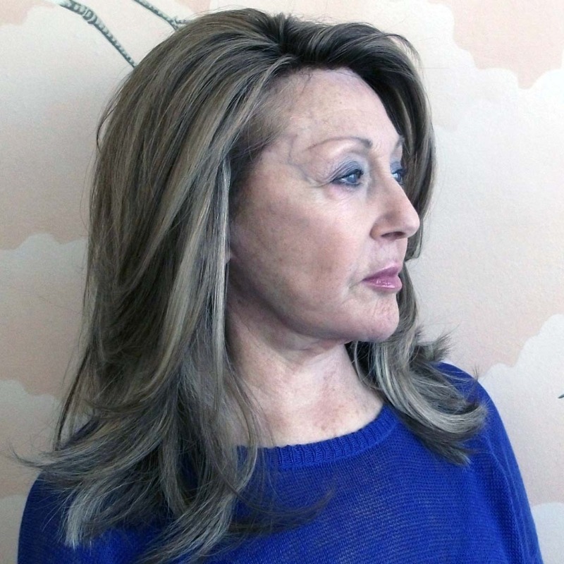 HairSolved's tweet photo. Female Pattern Baldness or Female Pattern Hair Loss is a form of Alopecia called Androgenic or Androgenetic Alopecia (APA). It is the most common type of female hair loss and typically presents itself as thinning at the crown of the head.
#femalepatternhairloss