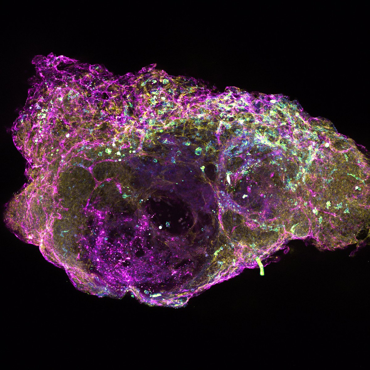 UoBAccelerate's tweet photo. First bone marrow organoids - paper and commentary in print today in Cancer Discovery.   

Paper - https://t.co/H1iUTsTeyA 

@CD_AACR @AbAttacks @unibirm_TRT @ICVS_UoB @unibirm_MDS 

#bonemarrow #organoid https://t.co/WuD4uYIxfK