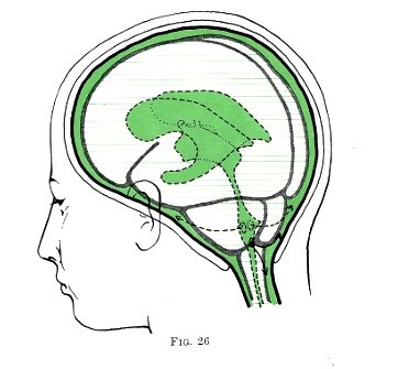 MerlinLarsonMD1's tweet image. You accidentally inject 20 cc of 2% lidocaine subarachniod. Patient is apneic, unresponsive. ? Plan: 1. Propofol then intubate or 2. Intubate without sedation?  Pupils are fixed and dilated. Why?  What is mechanism? Image: MacIntosh (1957).  TBC.