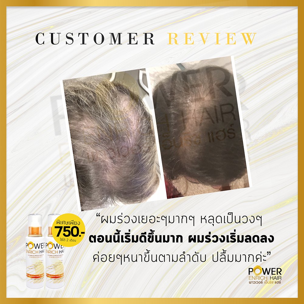 ปลูกผม ไรผม ผมร่วง เร่งผมยาว Power Enrich Hair tweet media