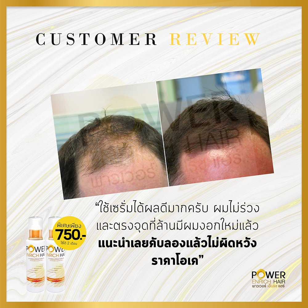 ปลูกผม ไรผม ผมร่วง เร่งผมยาว Power Enrich Hair tweet media