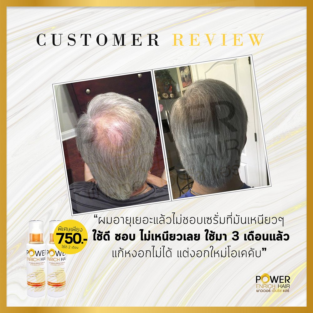 ปลูกผม ไรผม ผมร่วง เร่งผมยาว Power Enrich Hair tweet media