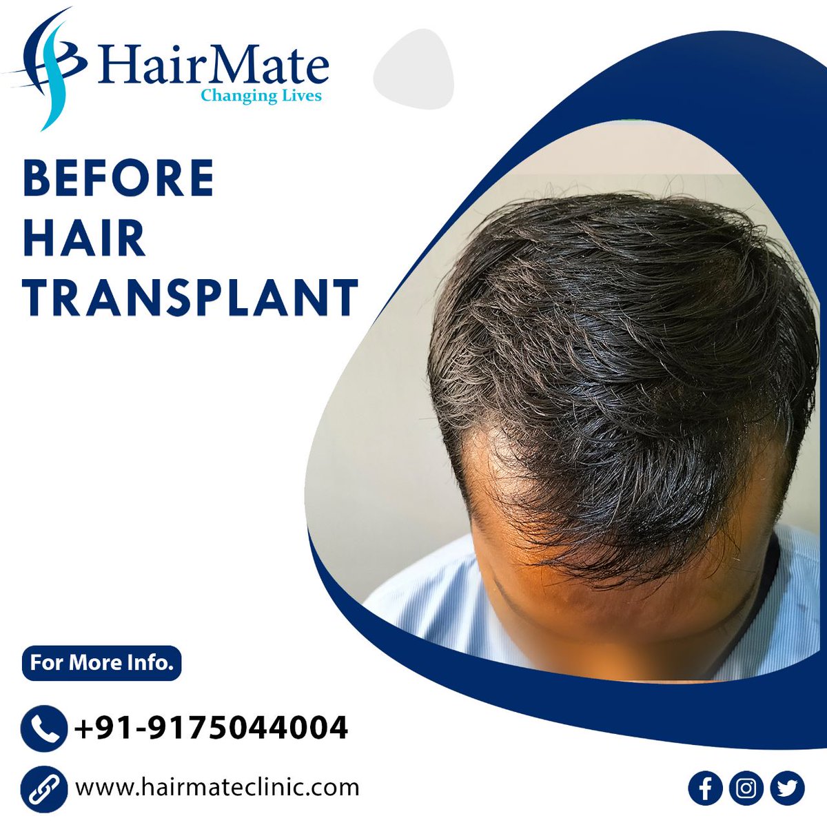 Hair Mate Clinic (@hairmateclinic) / Twitter Hair Mate Clinic (@hairmateclinic) / Twitter