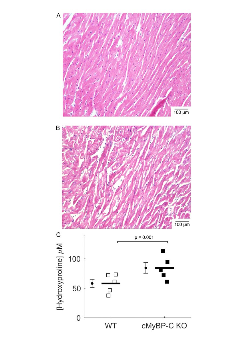 JGenPhysiol's tweet photo. RLC phosphorylation amplifies Ca2+ sensitivity of force in myocardium from cMyBP-C knockout mice, say Kyrah Turner, Bertrand Tanner @BertTannerLab and colleagues @WSUPullman: https://t.co/DORwxmIs98
#Contraction #CellMotility #Biophysics #MyofilamentFunction https://t.co/DW1gjfjxIV