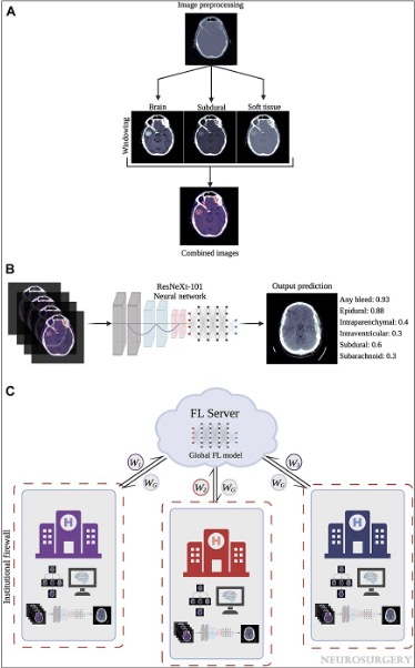 #NEUNew Methods and Impact for Using Federated Learning to Collaborate on Clinical Research bit.ly/3lcs4Ue by Cheung et al <a href="/nyugrossman/">NYU Grossman School of Medicine</a>
<a href="/ekoermann/">Eric Karl Oermann</a> @lola_chambless <a href="/Silky_Chotai/">Silky Chotai</a> <a href="/ToddCHollon/">Todd Hollon</a> <a href="/VivekBuchMD/">Vivek P. Buch, MD</a> <a href="/DKondziolkaCNS/">Douglas Kondziolka</a> <a href="/haboualshaar/">Hussam Abou-Al-Shaar</a> <a href="/JasNsgy/">Jas</a>  #Artificialintelligence