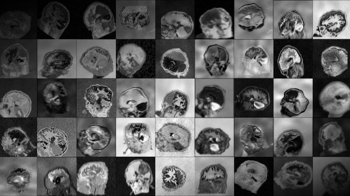Malte Hoffmann (@mh3936) on Twitter photo Make #ML models register specific image parts and adapt to new data types? New #preprint arxiv.org/abs/2301.11329. Code at w3id.org/synthmorph. <a href="/FreeSurferMRI/">FreeSurfer</a> <a href="/MGHMartinos/">MGH Martinos Center</a> <a href="/AdrianDalca/">Adrian Dalca</a> <a href="/MIT_CSAIL/">MIT CSAIL</a> <a href="/MIT/">Massachusetts Institute of Technology (MIT)</a> Make #ML models register specific image parts and adapt to new data types? New #preprint arxiv.org/abs/2301.11329. Code at w3id.org/synthmorph. <a href="/FreeSurferMRI/">FreeSurfer</a> <a href="/MGHMartinos/">MGH Martinos Center</a> <a href="/AdrianDalca/">Adrian Dalca</a> <a href="/MIT_CSAIL/">MIT CSAIL</a> <a href="/MIT/">Massachusetts Institute of Technology (MIT)</a>