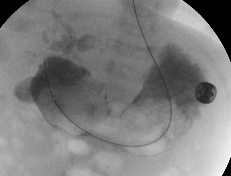 SocPedRad's tweet photo. SPR Unknown Case 310 Posted: Newborn with Trisomy 21 and abnormal prenatal US https://t.co/x8FujqF36o https://t.co/9RhXg8yhyx