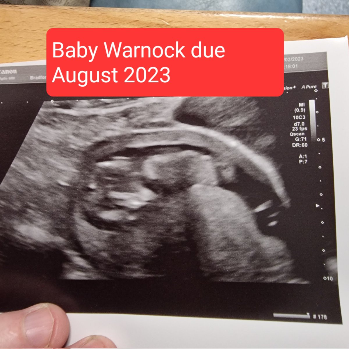 WORSLEY21's tweet photo. #NewProfilePic https://t.co/7H6WjN0SNL