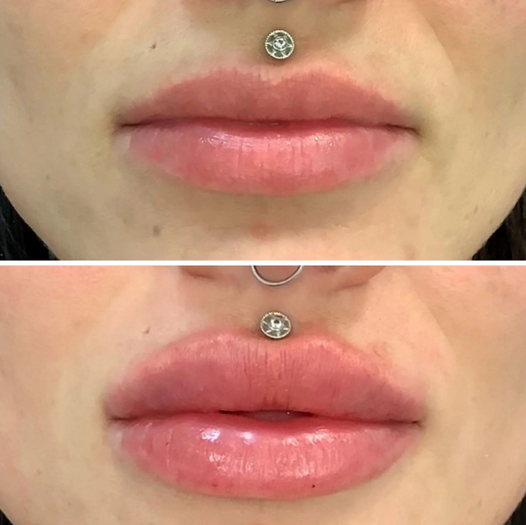 MD_Spa's tweet image. Contact us today:
Call: (780)9299797
Text: (780)9349021
DM: @MDSPALASER
Email: beaumont@mdspa.ca
Web: mdspa.ca

#edmonton #yeg #yeglocal #yegbusiness #alberta