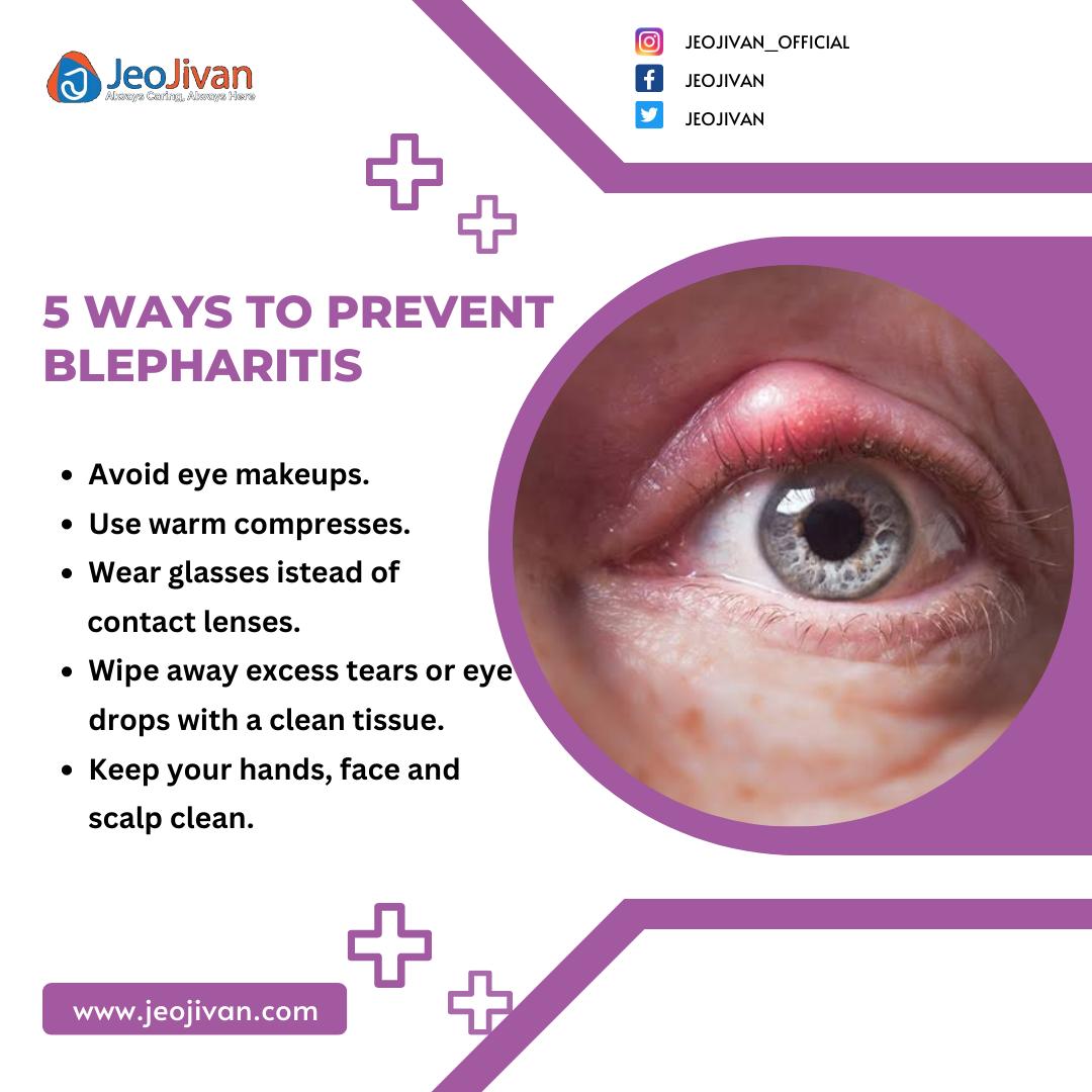 #healthyeyes #eyeshealth #jeojivan