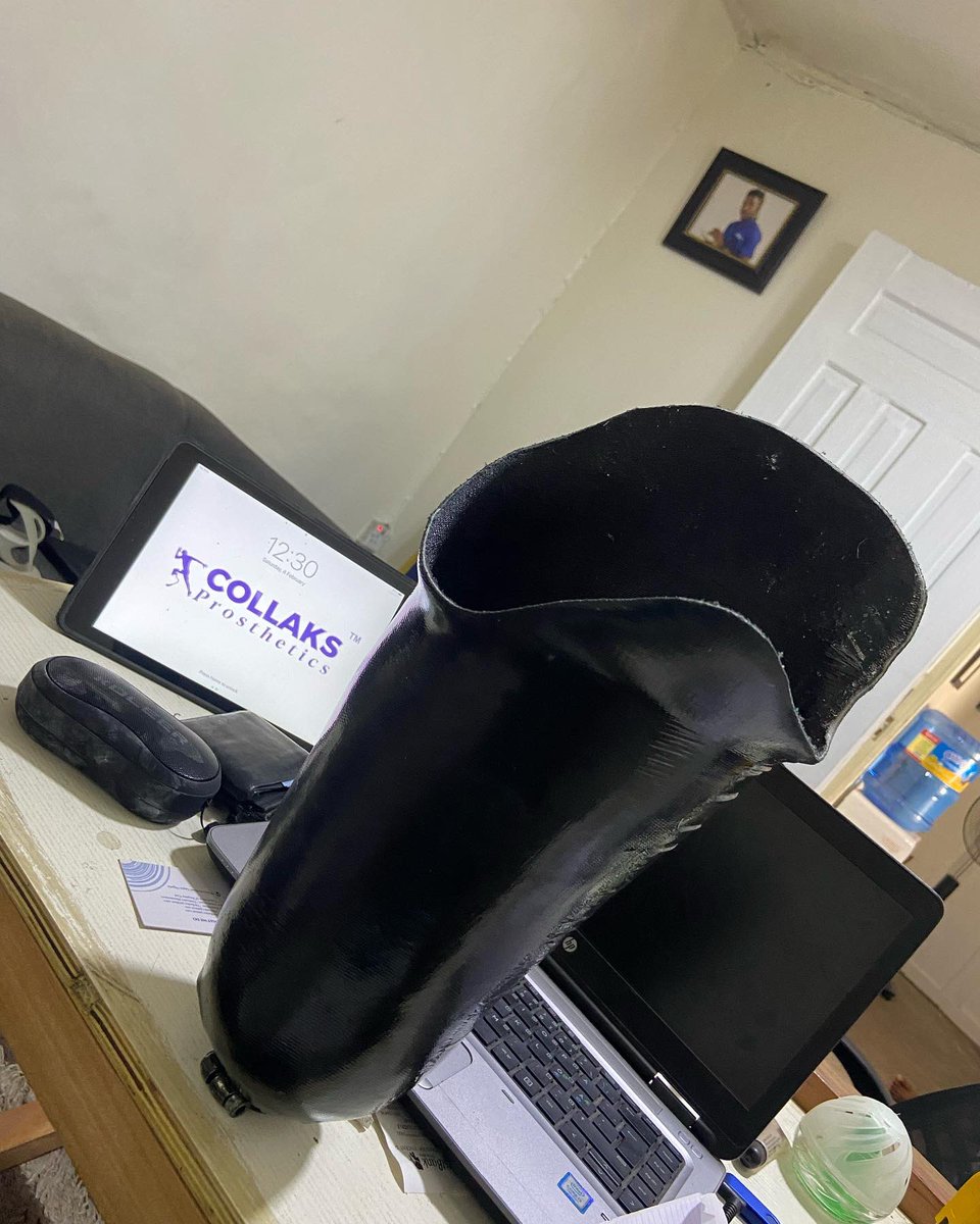 collakscare's tweet photo. My first ischial containment socket came out great #proted #ottbock #leg4africa #theiredefoundation #limbs https://t.co/wvIBSX7vtP