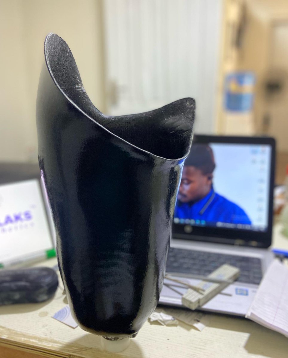 My first ischial containment socket came out great #proted #ottbock #leg4africa #theiredefoundation #limbs