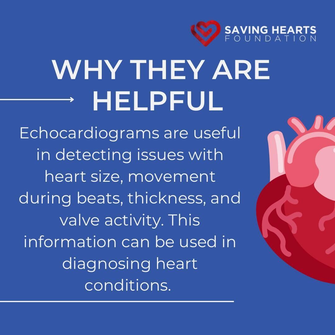 Sometimes when patients come to our screenings, our cardiologists recommend they get an echocardiogram for our on-site echo tech. Echocardiograms are ultrasounds of the heart.