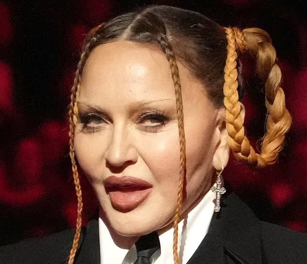 Nikki2U's tweet image. I don’t hate Madonna for doing this to herself. I hate that we live in a society where she thinks she has to do this to herself.