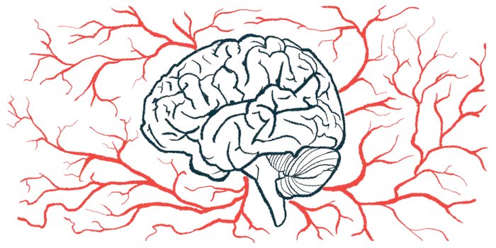 Subthalamic DBS was seen to help 97 Parkinson’s patients in Spain, whether their disease was considered due to mutations or of unknown cause. buff.ly/3DEsysD

#parkinsonssymptoms #parkinsonsdiseaseresearch #parkinsonsdisease #livingwithparkinsons