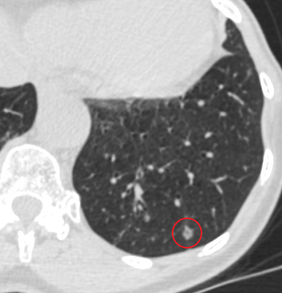 Ramsy Abdelghani, MD tweet media