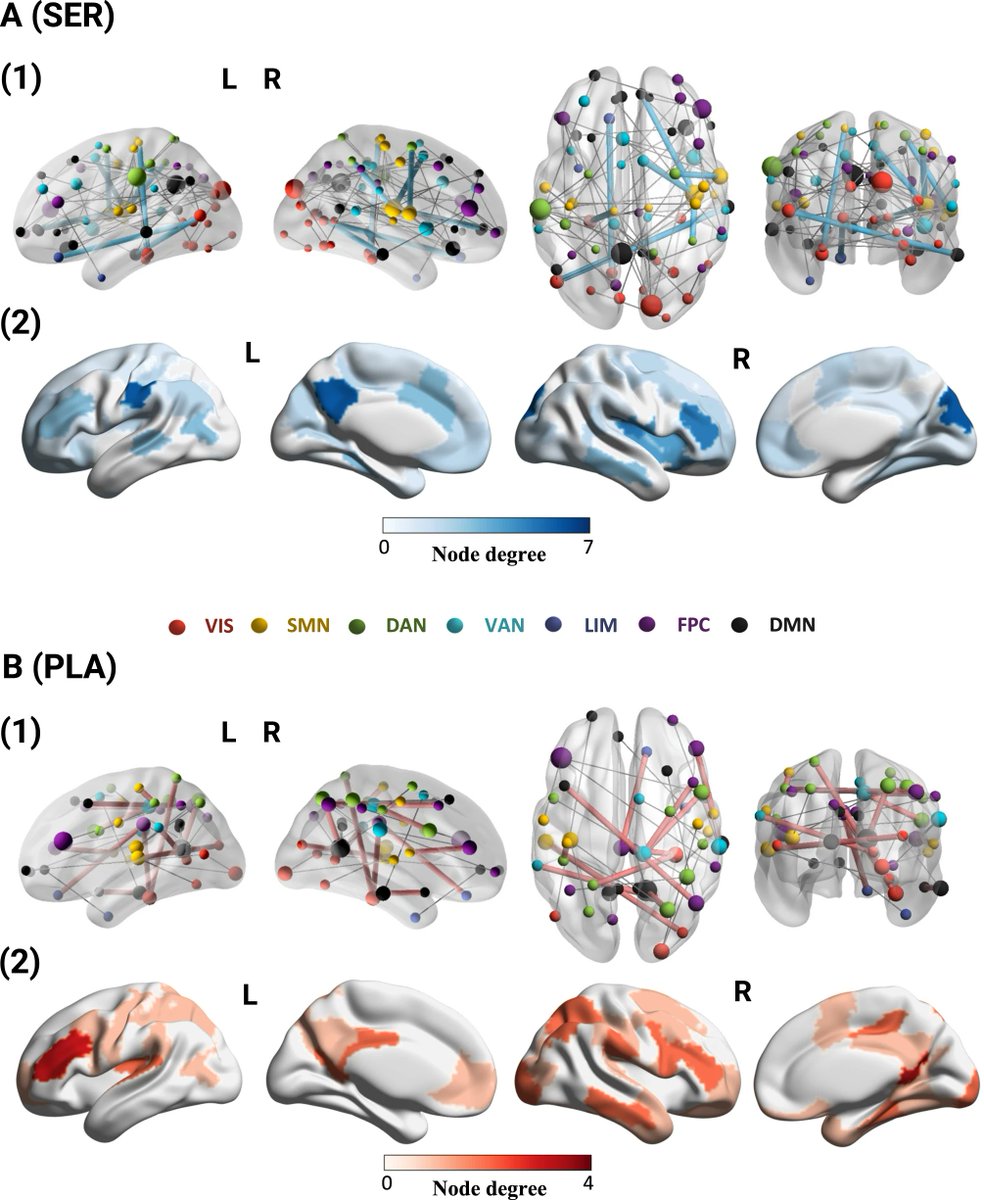 Individualized fMRI connectivity defines signatures of antidepressant and placebo responses in major depression. By Kanhao Zhao et al.  @LeHighU @LehighBioE @AltoNeuro #depression #biomarkers #MDD #majordepression #sertraline #fMRI #placebo #psychiatry rdcu.be/c4Xxd